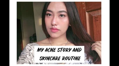 My Acne Story And Skincare Routine Youtube