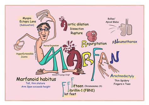 Marfan Syndrome What Is Marfan Syndrome Images And Photos Finder
