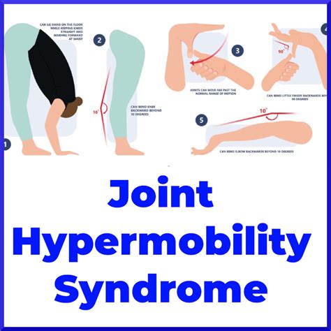 Joint Hypermobility Syndrome Sports Medicine Review