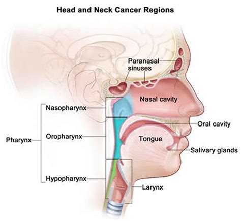 Cancer Types Of Head And Neck Head And Neck Cancer Symptoms And Signs