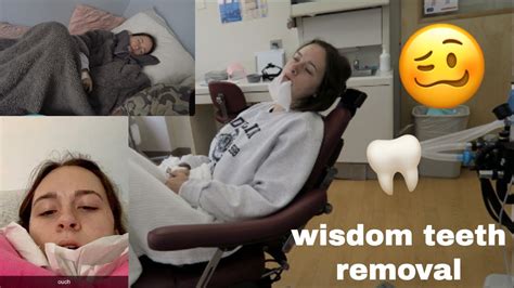 getting my wisdom teeth removed youtube