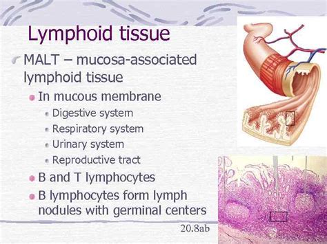 Malt inductive sites are secondary immune tissues where antigen sampling occurs and immune responses are initiated. Lymphatic System review Introduction Components Lymph is