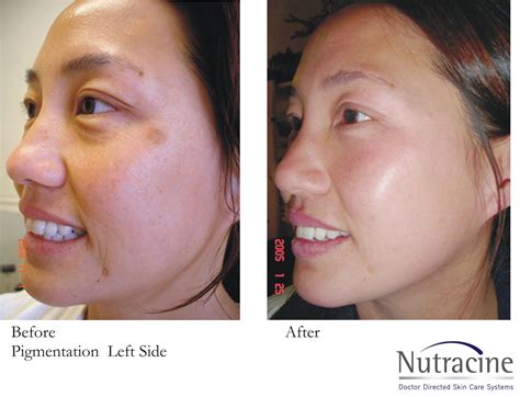We did not find results for: Before and After - Nutracine Skin
