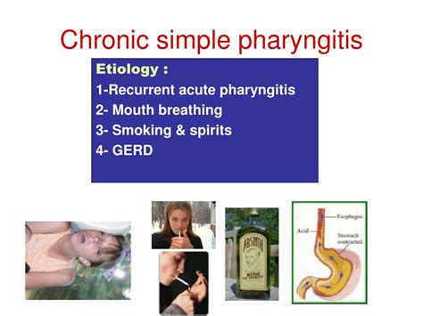 Ppt Chronic Pharyngitis Powerpoint Presentation Free Download Id