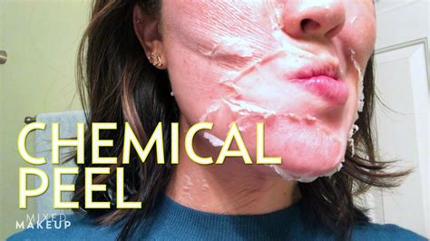 How To Care For Your Skin After A Perfect Derma Chemical Peel — Mixed