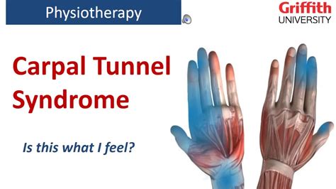 Physiotherapy For Carpal Tunnel Syndrome Griffith Physiotherapy
