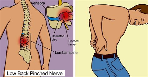 I hope you like it and enjoy. How to spot a slipped disk and what to do about it