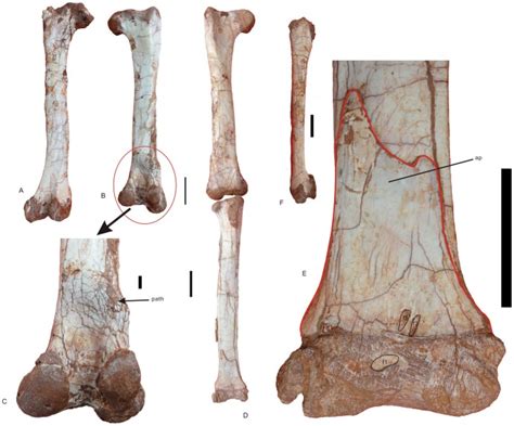 A Left Femur In Posterior View B Right Femur In Posterior View C