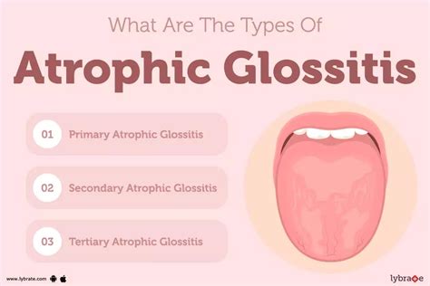 Atrophic Glossitis Causes Symptoms Treatment And Cost