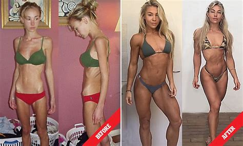 Model 29 Whose Weight Dropped When She Had Anorexia Reveals How She