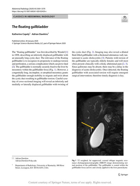 The Floating Gallbladder