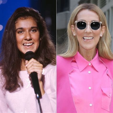 Celebrity Teeth Transformations From Celine Dion To Victoria Beckham Kylie Jenner More HELLO