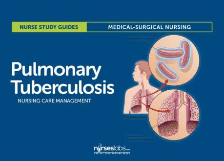 Pulmonary Tuberculosis Nursing Care Management And Study Guide Nurseslabs