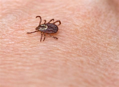 Ticks Carrying Lyme Disease Bacteria Found In Rouge Valley Toronto Star
