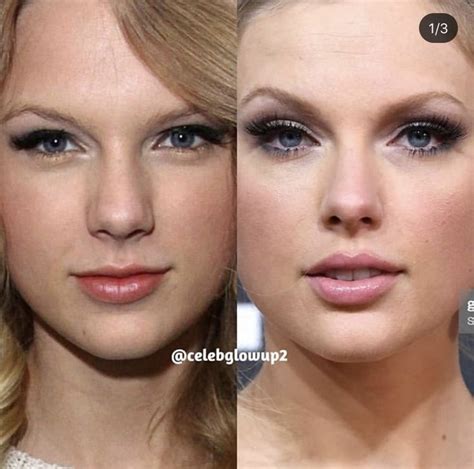 Taylor Swift New Nose Celebrity Plastic Surgery Celebrities Before