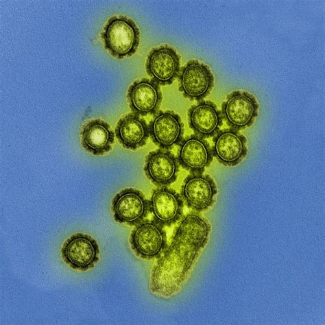 A Colorized Transmission Electron Micrograph Shows H1n1 Influenza Virus Particles Surface
