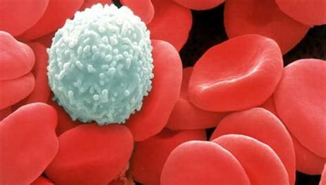 3 Steps To Understanding High Elevated White Blood Cell Count Wbc Count