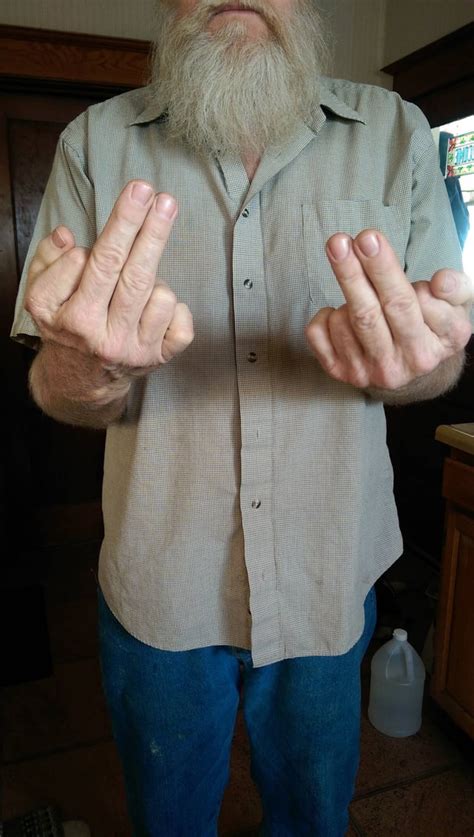 My Dad Has 6 Fingers On Each Hand He Uses 2 Fingers To Flip Someone