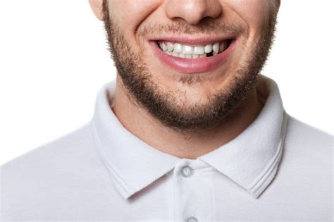 Teeth and jawbone do not match. Is it time to get rid of the gaps in your smile? - My ...