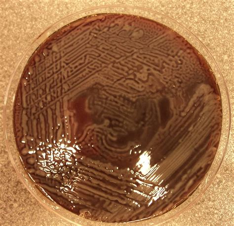 Proteus Mirabilis On Blood Agar