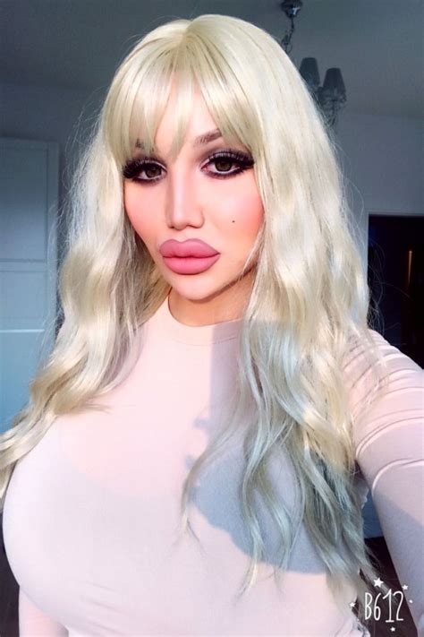 Transgender Woman Spends £110000 On Surgery To Look Like A Human Doll