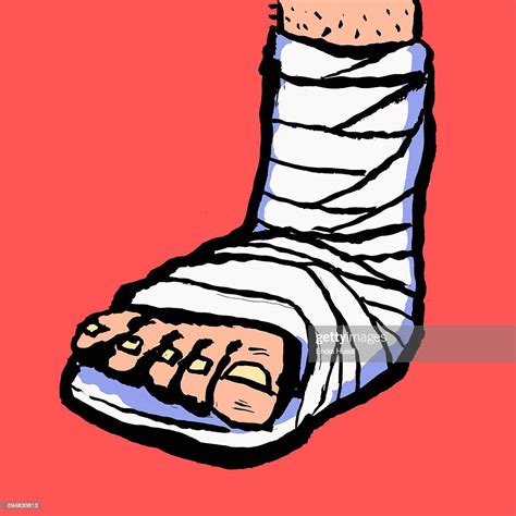 Illustration Of Leg With Bandage Against Red Background High Res Vector