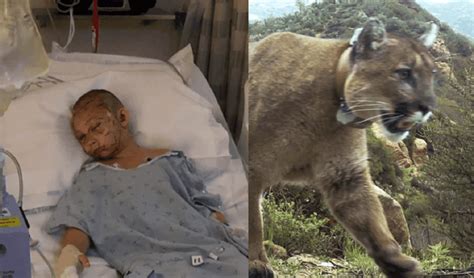 9 Year Old Girl Wakes Up From Coma After Miraculously Surviving Rare Cougar Attack Nigerian