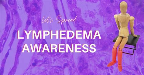 Lymphedema Awareness From The Experts Mouth Ftem