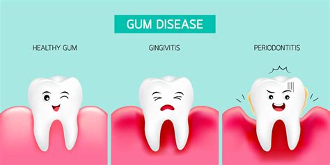 The Importance Of Healthy Gums For Your Oral Health And Teeth