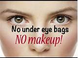 Pictures of Bags Under Eyes Makeup