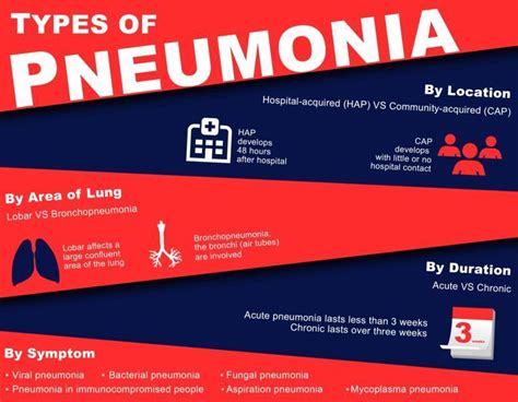 Everything About Bacterial Pneumonia Its Causes Symptoms Diagnosis