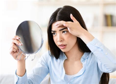Forehead Acne Meanings Causes Preventions And Treatments