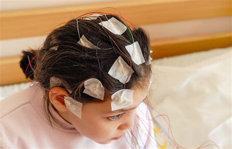 Ultimate Guide To The EEG Test Seer Medical