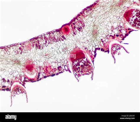 Parasitic Plant Fungus Puccinia Microscope Slide Stock Photo Alamy