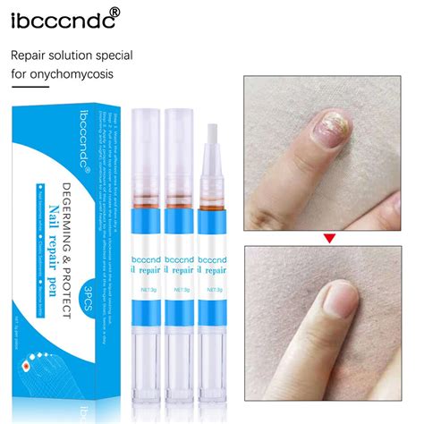 3pcsbox Home Recovery Nail Repair Liquid Effective Toe Protect