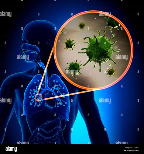 El Virus Del Resfriado Gripe Fotografía De Stock Alamy