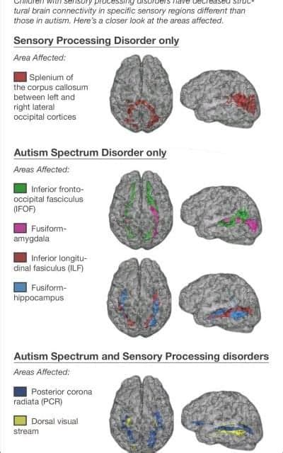 Autism Spectrum Disorder Brain The Autistic Brain The Autistic Brain
