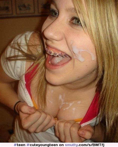 Cum On Girls Face With Braces