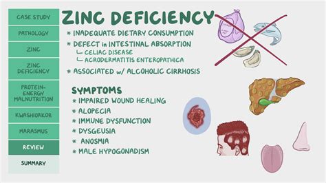 Zinc Deficiency And Protein Energy Malnutrition Pathology Review Osmosis Free Nude Porn Photos