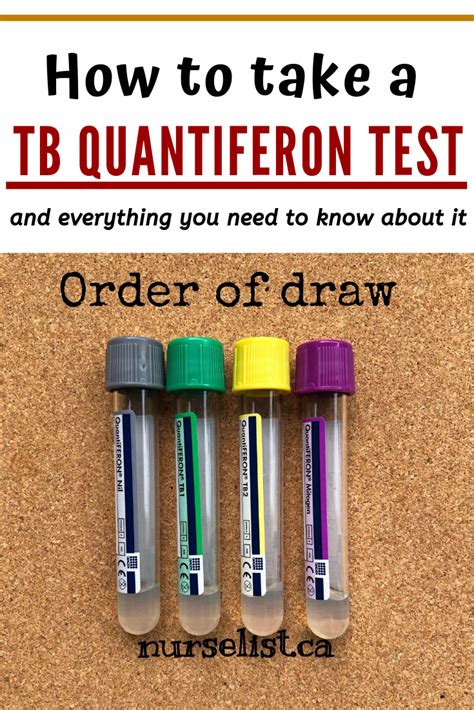 Tb Quantiferon Test Guide