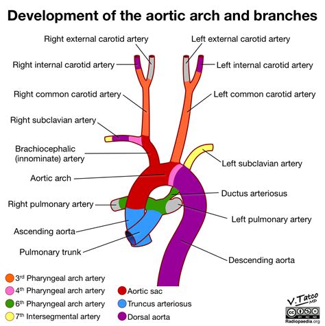 Radiopaedia Drawing Development Of The Aortic Arch And Branches After