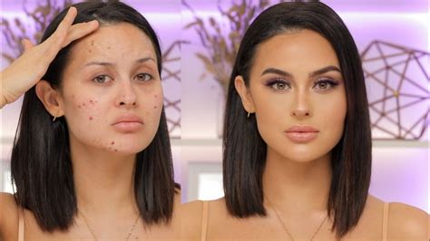 Flawless Skin Transformation With Makeup For Acne Breakouts Youtube