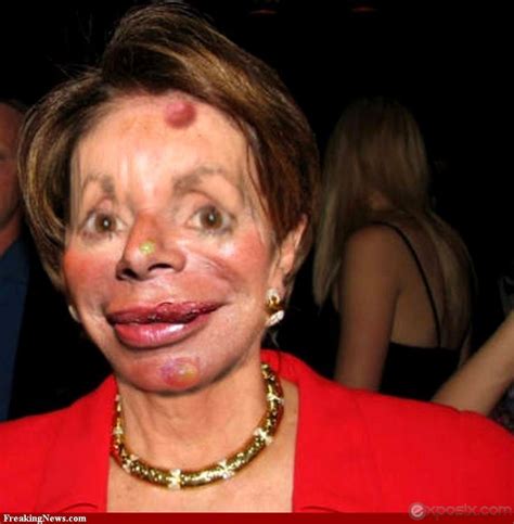 More Plastic Surgery Gone Wrong Nancy Pelosi With Botox Gone Wrong