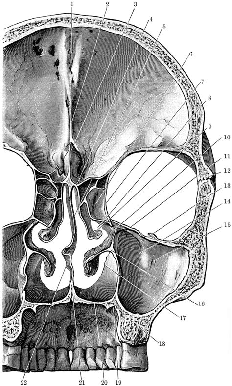 Coronal Section Of Skull Clipart Etc