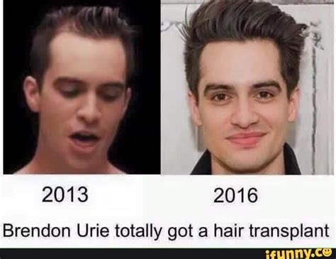 Brendon Urie Totally Got A Hair Transplant Ifunny