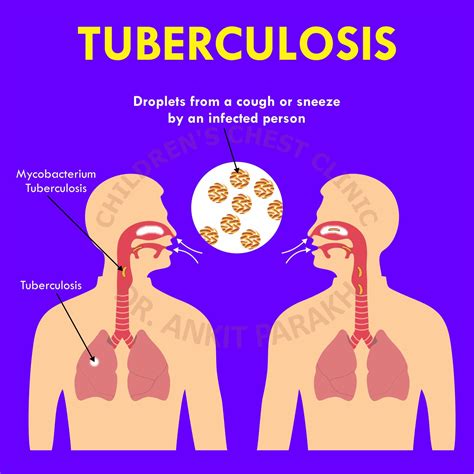 Tuberculosis Dr Ankit Parakh