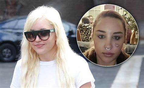 Amanda Bynes Appears To Be Removing Face Tattoo After Mental Health Center Check In