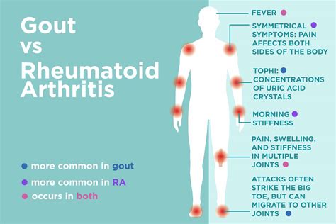 What Is The Difference Between Arthritis And Rheumatoid Arthritis