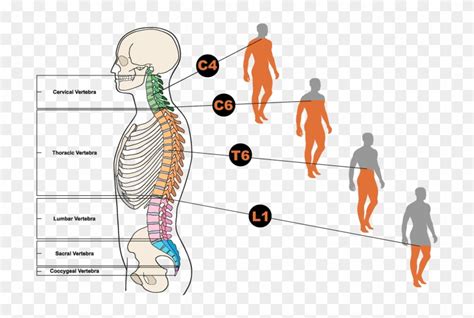 Different Types Of Spinal Injuries