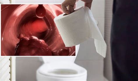 Bowel Cancer Symptoms Bright Red Blood In Poo Is A Sign Uk